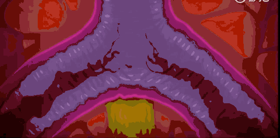 9.gif